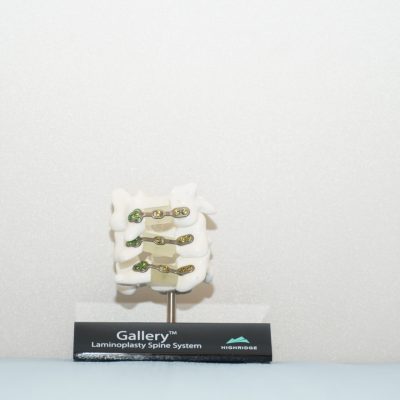 Gallery™ Laminoplasty Spine System -  C4-C6