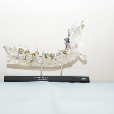 Lineum¨ Occipito-Cervico-Thoracic (OCT) Spine System -  OCC-T4