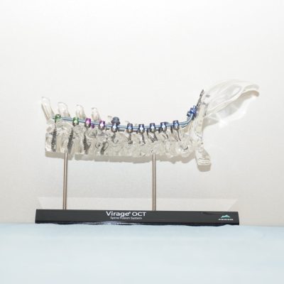 Virage¨ OCT Spinal Fixation System  -  OCC-T3
