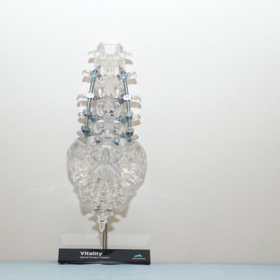 Vitality® Spinal Fixation System -  SAC-L2